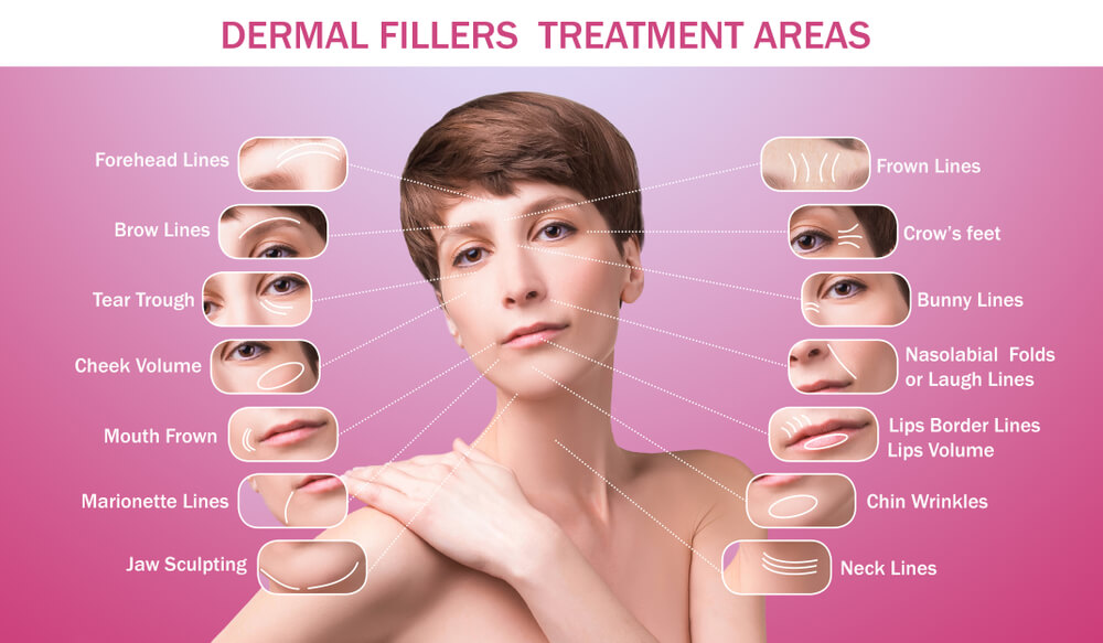dermal fillers in Tampa