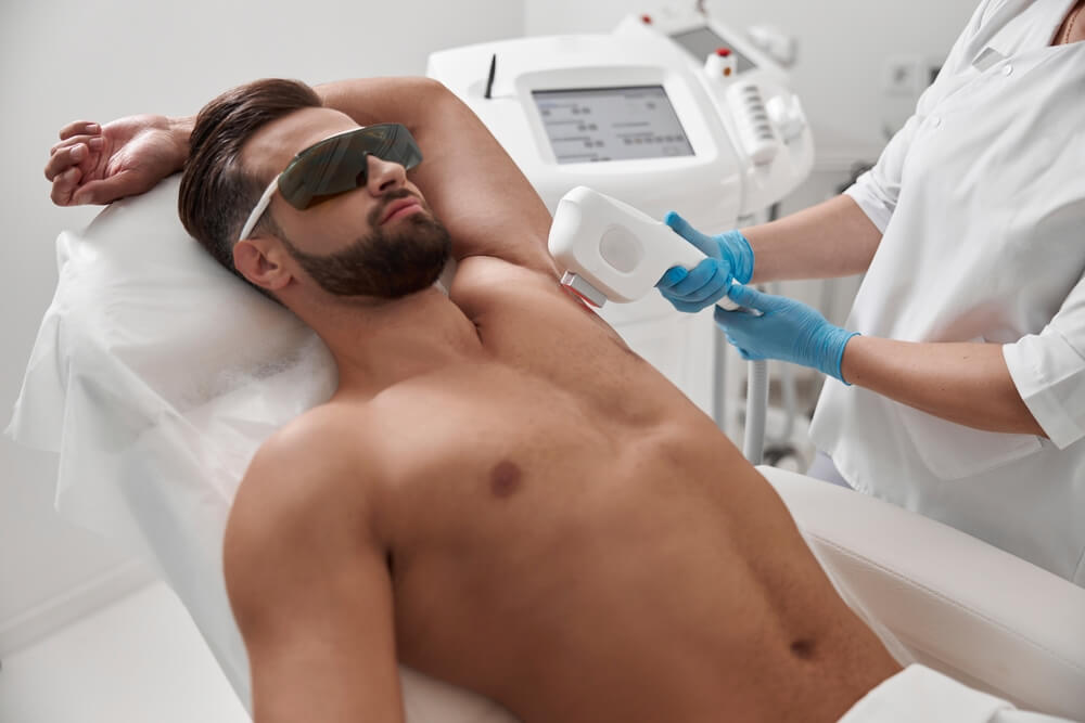 laser hair removal treatment