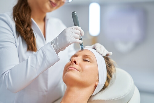Microneedling in Tampa Florida