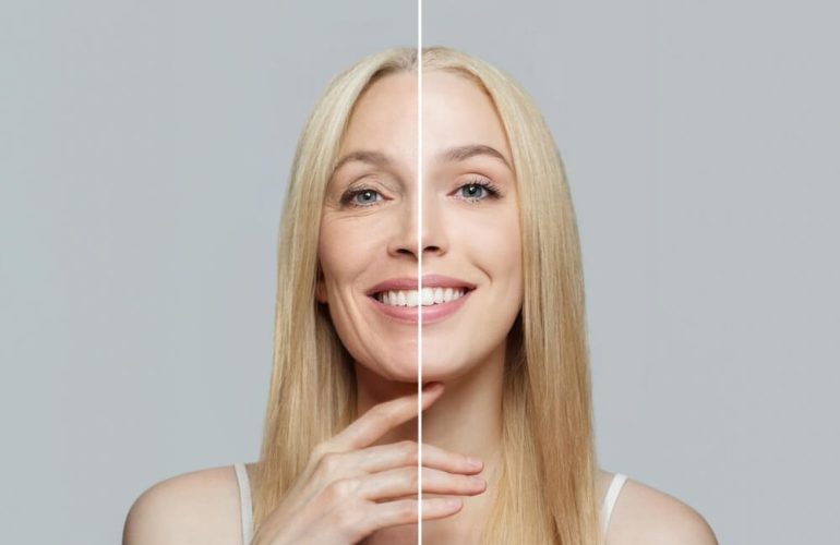 red light therapy before and after