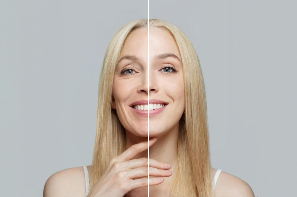 red light therapy before and after