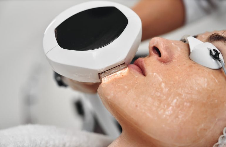 laser hair removal at clinic