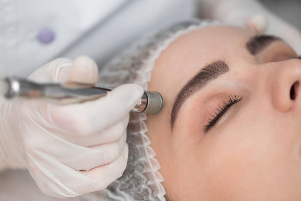 Microdermabrasion is a minimally invasive exfoliating treatment that uses a fine crystal or a diamond-tipped instrument