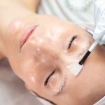 woman getting enzyme peel treatment