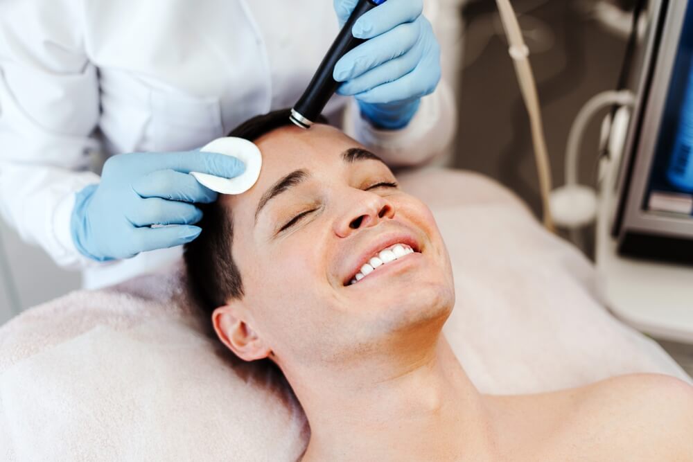 Who Is a Good Candidate for Microdermabrasion for Acne?
