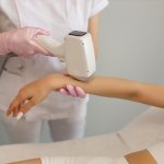 candela laser hair removal process