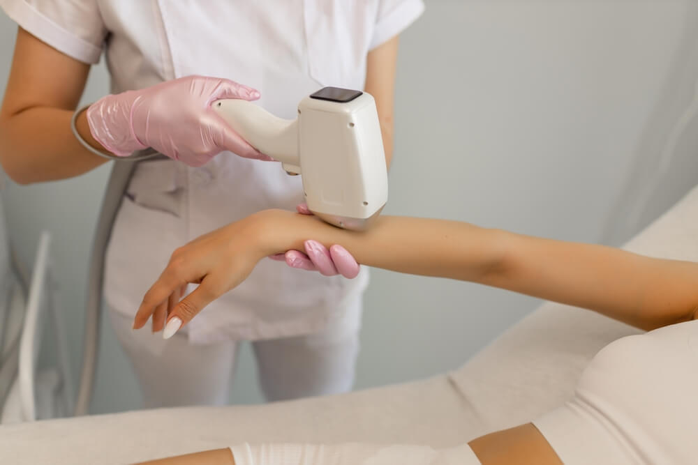 candela laser hair removal process