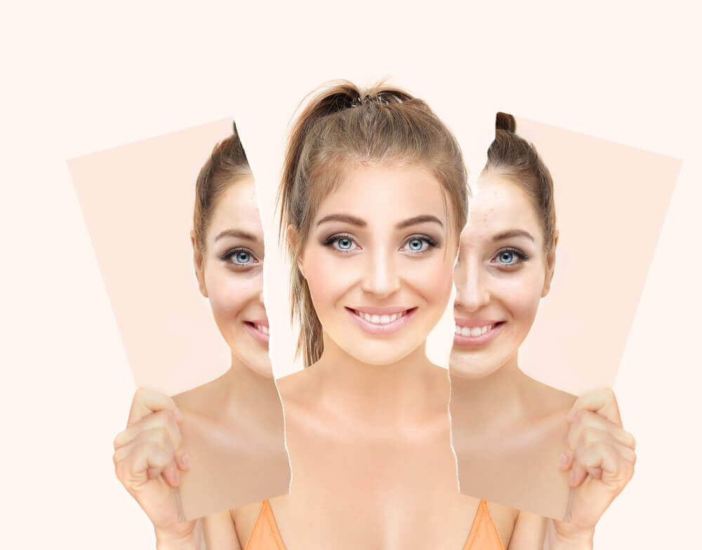 Before and after results showing improved skin texture and glow after HydraFacial treatment