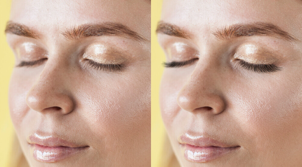 European facial before and after results showing brighter, smoother, and glowing skin