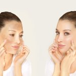 Woman after chemical peel treatment at a professional medspa, showing smooth skin rejuvenation and acne scar improvemen