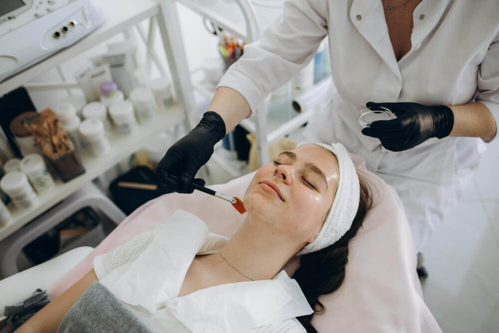 Skincare specialist performing a chemical peel on a client, demonstrating exfoliation and controlled skin regeneration for acne scar treatment.
