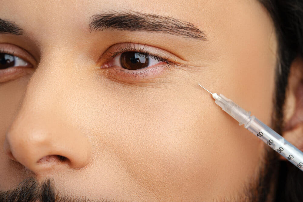 Close-up of hooded eyelids showing excess skin over eyelid